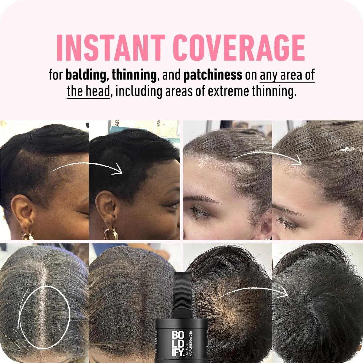Boldify Hairline Powder   Hair Fiber (Dark Brown): bundle that Instantly Conceals Hair Loss Hair Powder for Thinning Hair, Root Cover Up (Dark Brown)