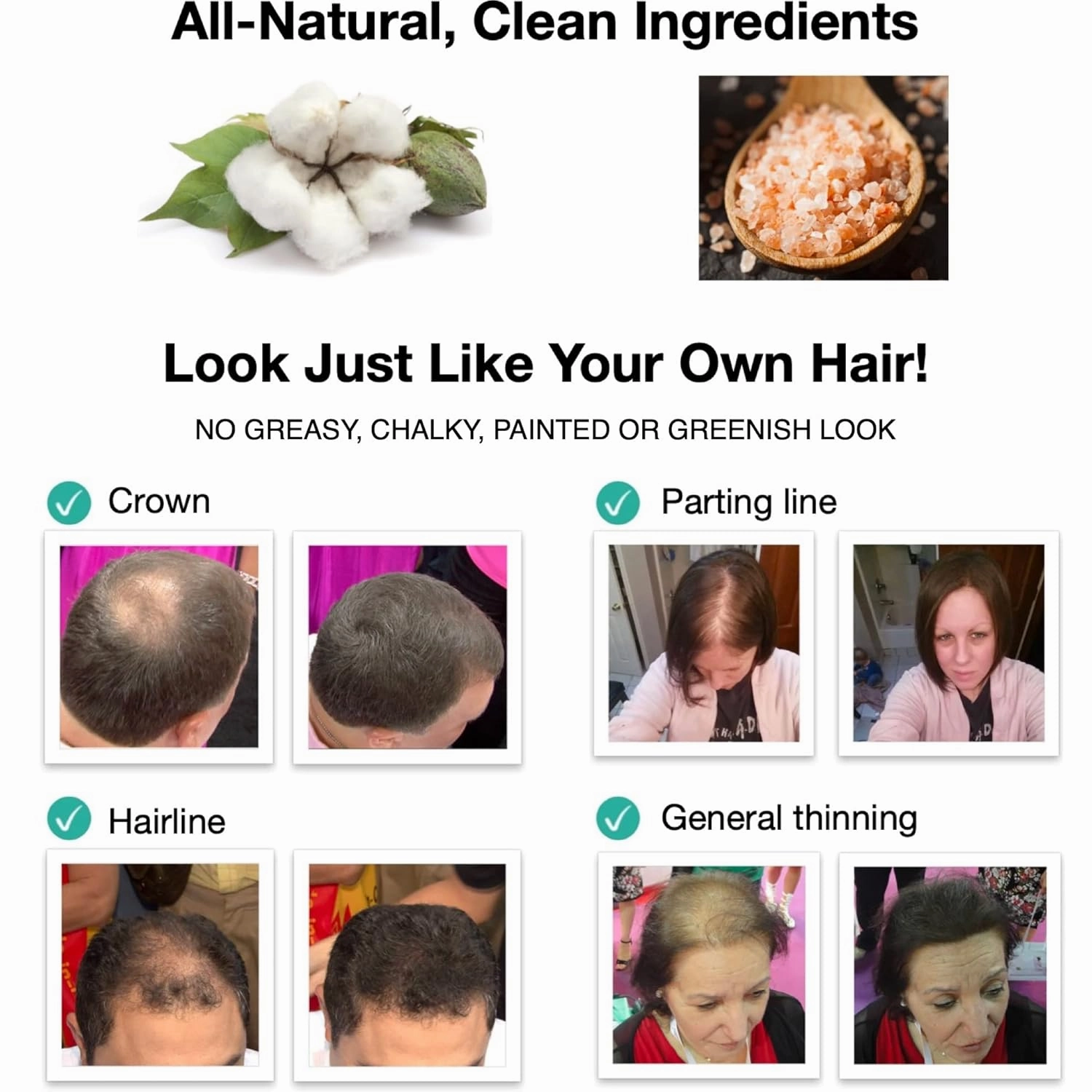 Caboki Hair Loss Concealer. All-Natural, Plant-Based Hair Building Fiber. Covers Bald Spot and Thinning Hair. Makes Thin Hair Look 10X Fuller Instantly (30G, 90-Day Supply). Natural Blonde