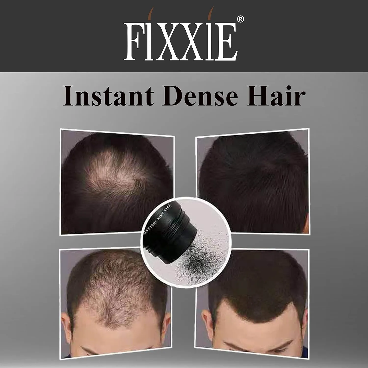 FIXXIE Hair Fibers for Thinning Hair WHITE 27.5g Bottle, Hair Fibre Concealer for Hair Loss for Men and Women, Naturally Thicker Looking Hair with Keratin Hair Fibres