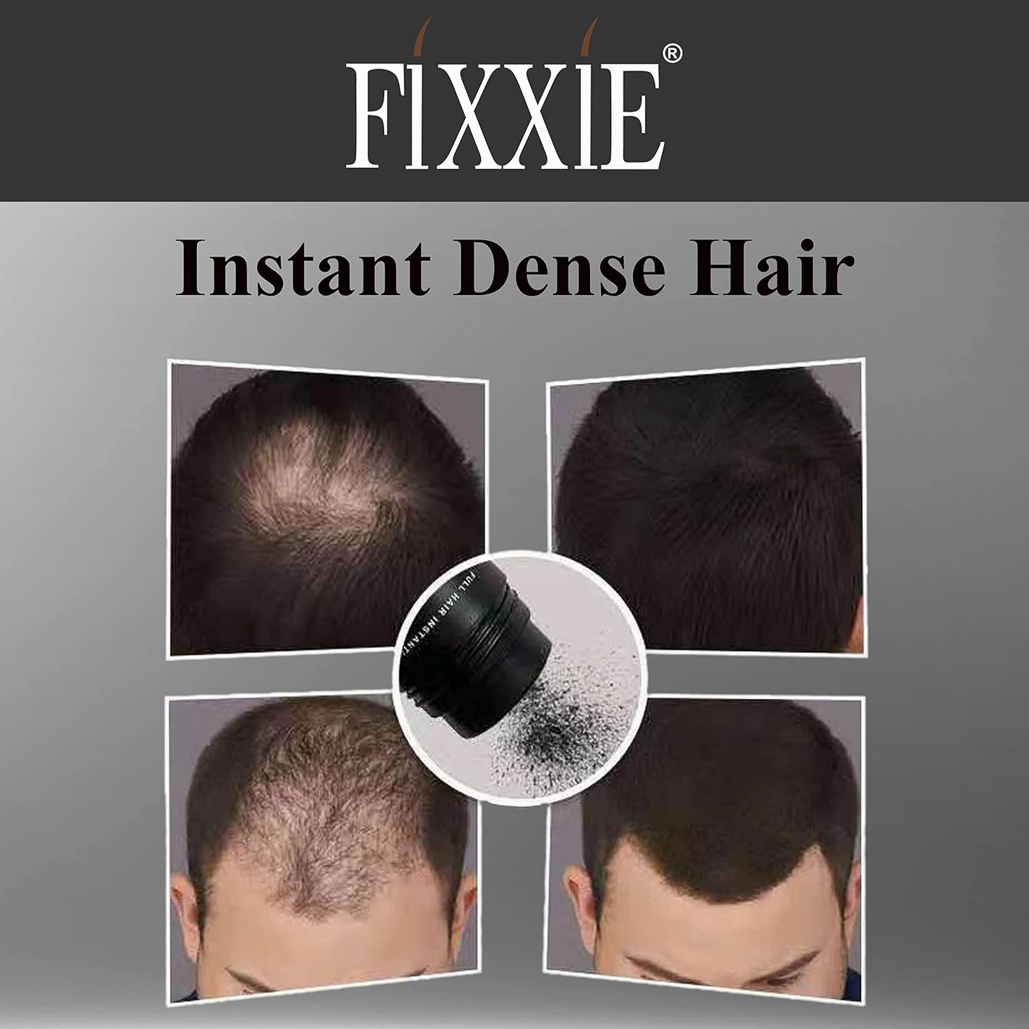 FIXXIE Hair Fibers MEDIUM BROWN for Thinning Hair 27.5g Bottle, Hair Fibre Concealer for Hair Loss for Men and Women, Naturally Thicker Looking Hair with Keratin Hair Fibres