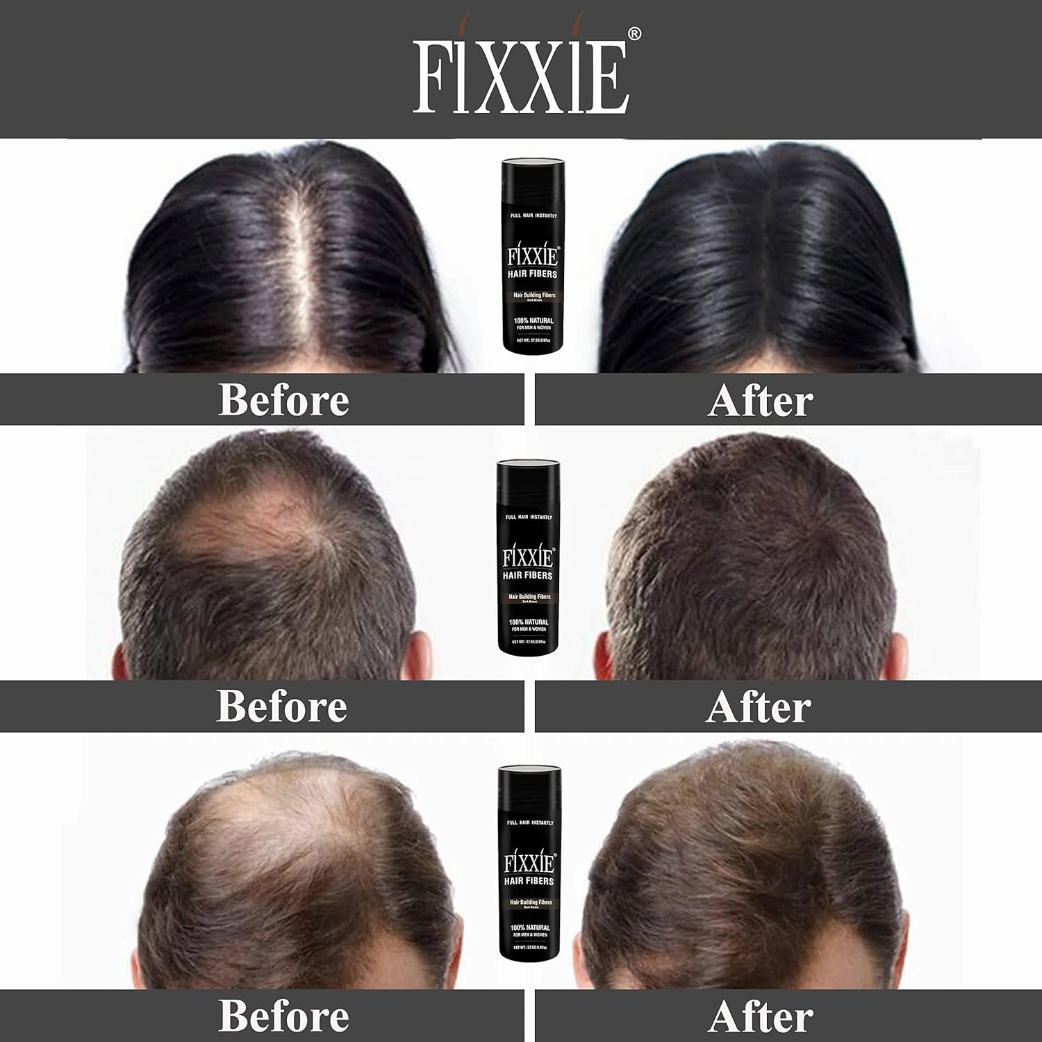 FIXXIE Hair Fibers MEDIUM BROWN for Thinning Hair 27.5g Bottle, Hair Fibre Concealer for Hair Loss for Men and Women, Naturally Thicker Looking Hair with Keratin Hair Fibres