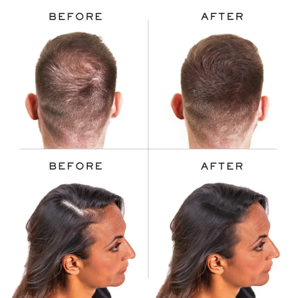 Hair Thickening Keratin Fibres Dark Brown