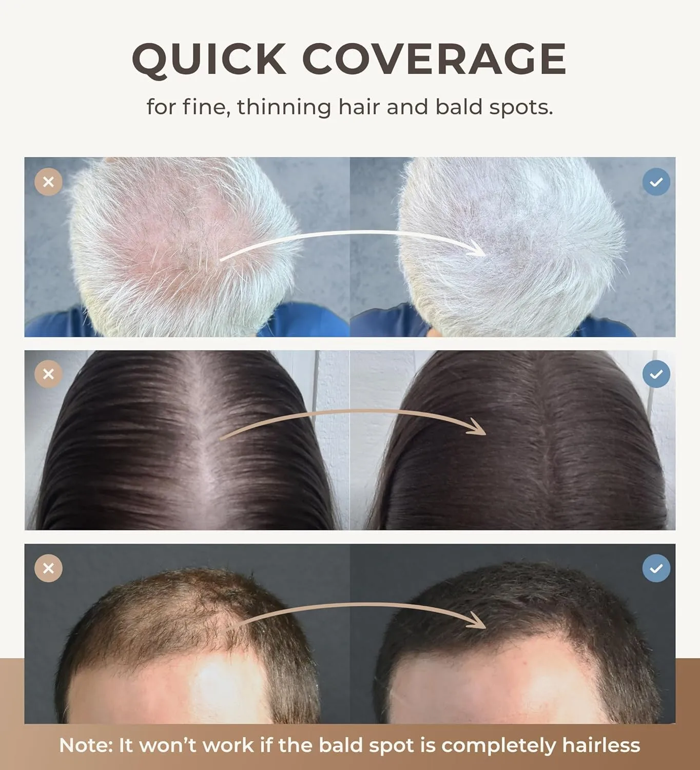 Keratin Hair Fibers for Men & Women - Fill In Fine or Thinning Hair, Instantly Thicker, Fuller Looking Hair (Dark Brown 30g)