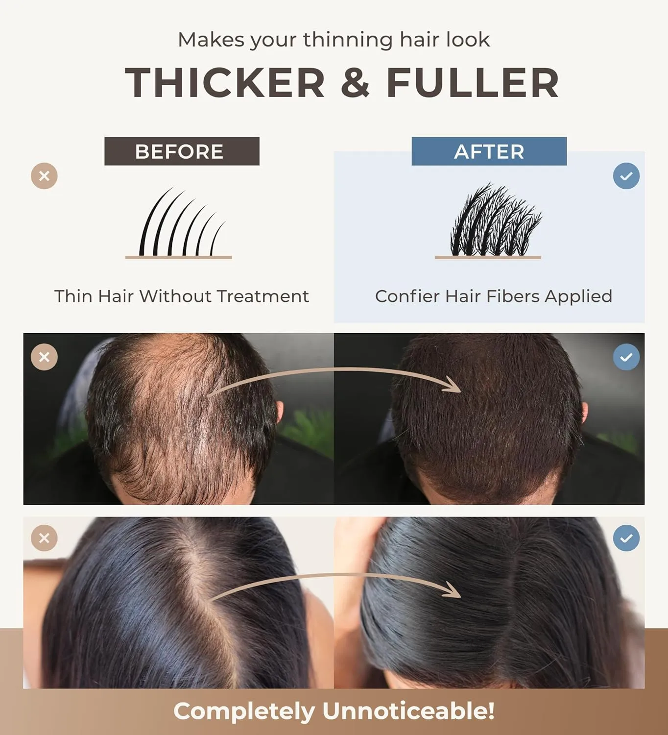 Keratin Hair Fibers for Men & Women - Fill In Fine or Thinning Hair, Instantly Thicker, Fuller Looking Hair (Dark Brown 30g)