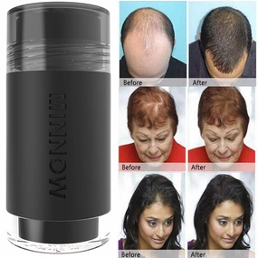 MINNOW Hair Building Fibers,Keratin Hair Fibers Hair Loss Concealer For Thinning Hair Powder Volumizing Based,16grams/0.56oz (DARK BROWN)