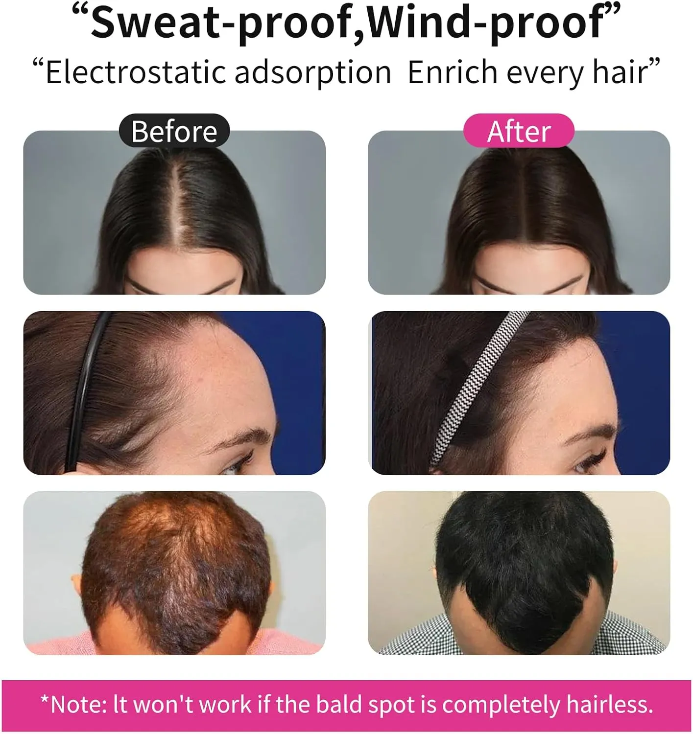 SEVICH Hair Fibers Refill 100g - Compatible with Most Brand Bottles | Hair Building Fibers for Thinning Hair | Instant Thickening Powder for Men & Women | 5-Second Natural Coverage,Black