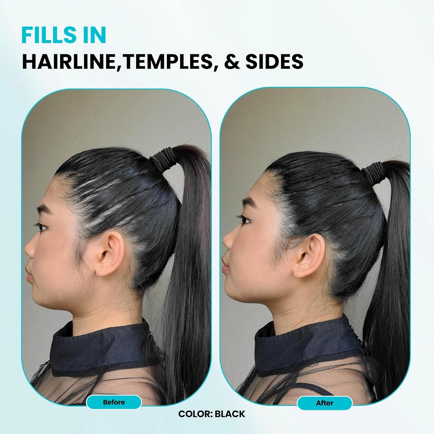 SURETHIK Building Hair Fibers to conceal thinning hair, Instantly Fuller Looking Hair for Men & Women, Auburn, 15g