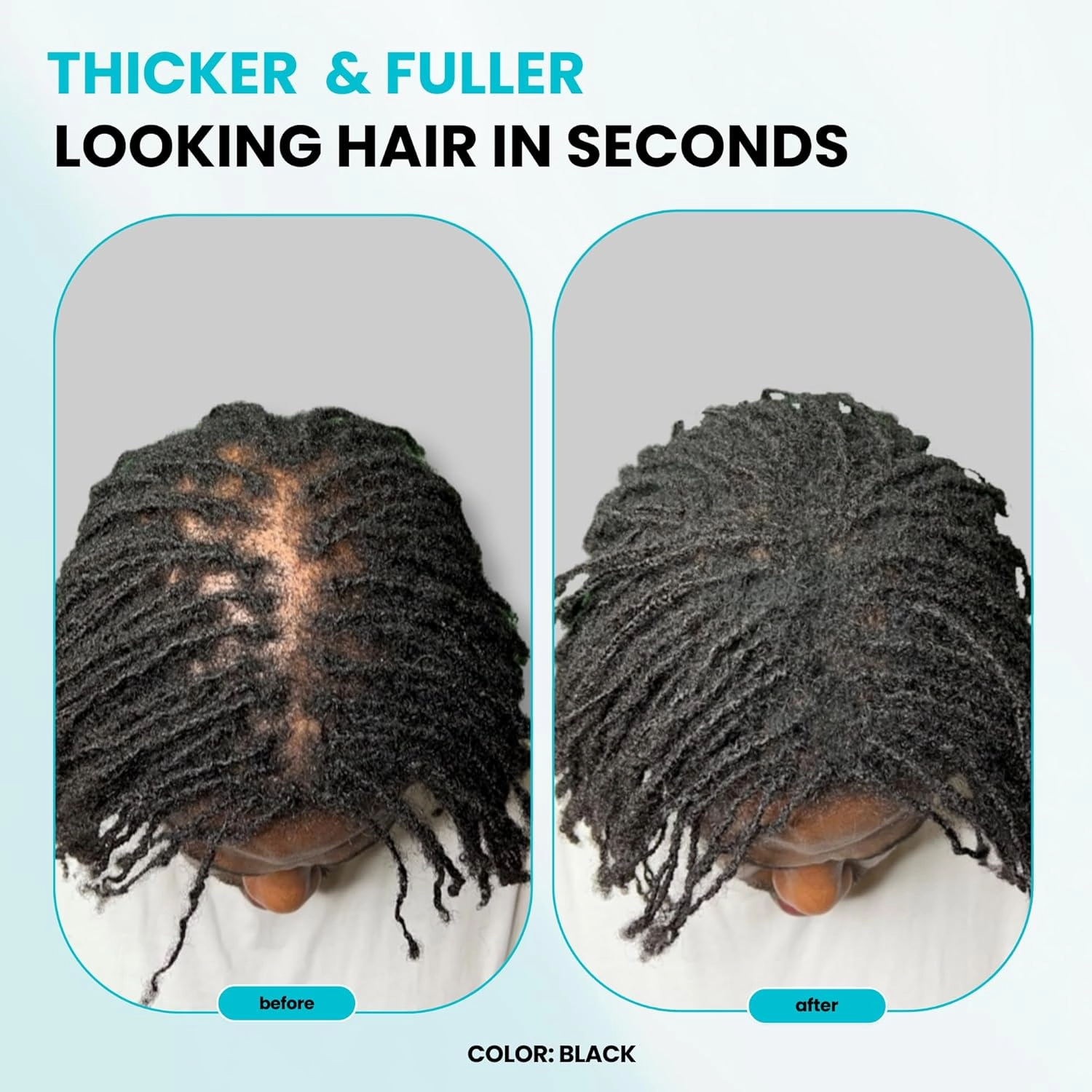 SURETHIK Building Hair Fibers to conceal thinning hair, Instantly Fuller Looking Hair for Men & Women, Auburn, 15g