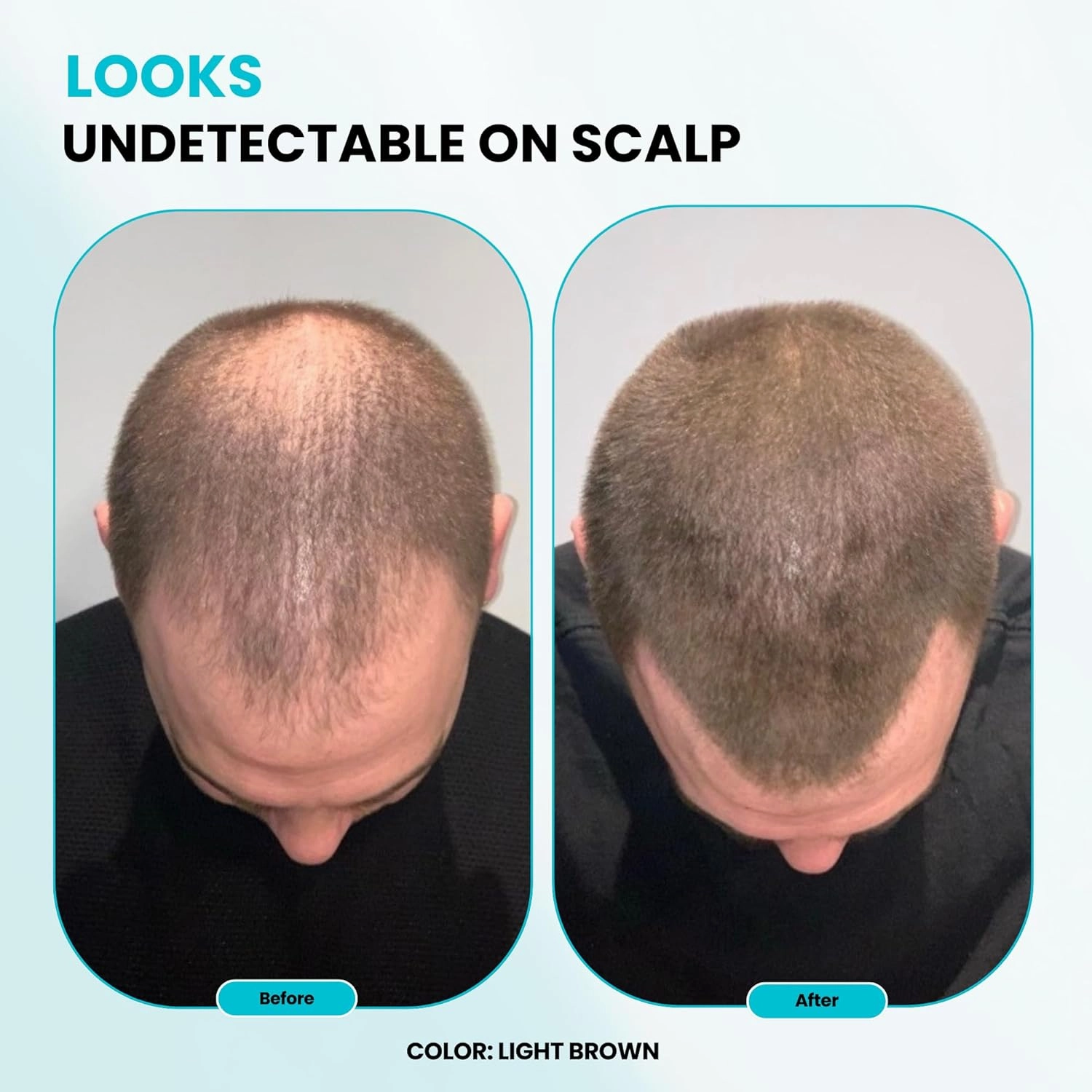 SURETHIK Building Hair Fibers to conceal thinning hair, Instantly Fuller Looking Hair for Men & Women, Auburn, 15g
